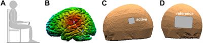 Transcranial Direct Current Stimulation on Parietal Operculum Contralateral to the Moving Limb Does Not Affect the Programming of Intra-Limb Anticipatory Postural Adjustments